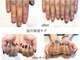 ビューティーサロン リコ(BeautySalon Rico)の写真/【お試し◆自爪育成ネイルケア¥6000】深爪矯正でコンプレックスだった自爪が見違えるほど美しいフォルムへ!