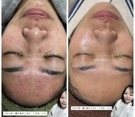 サロン アンネ(Anne)