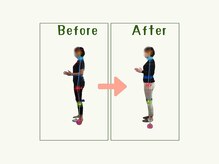 【痩身/ダイエット/整体/骨盤矯正】専門サロン アテオス/40代　肩こり・背中の痛み・痺れ