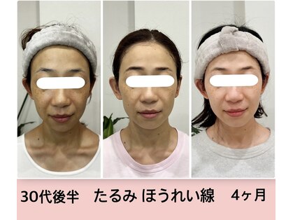 ボディーサポートソワンの写真