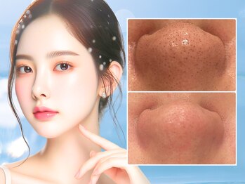 ウィア 越谷店(Uvia)/透明肌管理～韓国式３D洗浄～