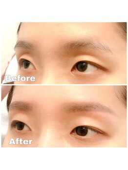 ビビデバビデ(Vivide Vavide)/下がり眉 解消!