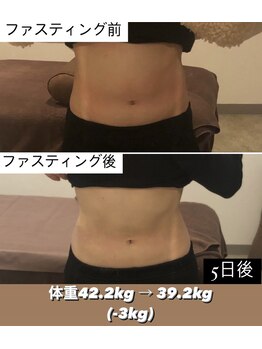 東京デトックス/ファスティングビフォアフ