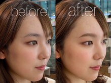 ビューティーガーデン イース/BEFORE→AFTER