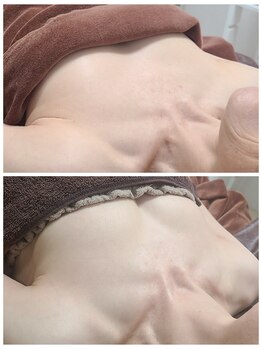 イベリス(IBERIS.)/当店ビフォーアフター