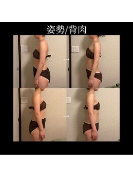 美骨(BIKOTSU)/姿勢矯正