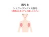 脇シュガーリング＋光脱毛◎剃毛不要　45分￥6,000