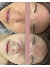 チュチュ(TUTU)/究極のエイジングケア