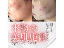 ラナサロン(Lana salon)の雰囲気（極上の透明感を手に入れる。贅沢な最高級の美肌ケア♪）
