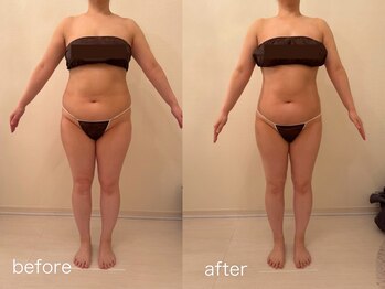 クロレ 浦和店(CLORE)/40代のお客様/10回施術