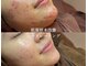 インディビューティー 六本木店(inde beauty)の写真