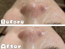 グラシア 倉敷店(Gracia)/お客様の施術事例