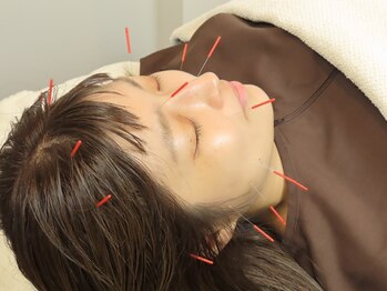 リトリートハリ 銀座院(Re:treat HARi)の写真/【美容鍼灸】たるみケア/しわ改善/小顔/ニキビケア/むくみ予防に！肌質改善やエイジングケアにも効果的◎