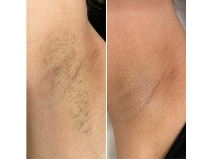 シャルム(Charme)の写真