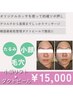 【ハリ艶肌になれる】フェイシャルスクール講師施術ダクトピールフェイシャル
