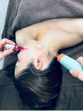 サロン ベル(salon Belle)/RED SHOT６つ老け顔脂肪改善