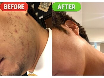 ミスターセブン 下北沢 世田谷店(Mr7)の写真/青ヒゲ・濃いヒゲに悩む方へ|下北沢駅2分|最短15分・痛み少ない・都度払い