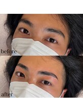 ダリ(Dali)/メンズハリウッドブロウリフト