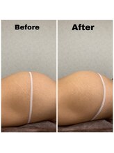 ブーケ/フェムケア　Before & After