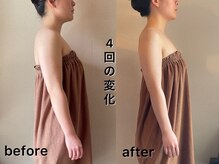 ミヌレ 大阪店(minulle)/別人級！フェイスラインの変化も