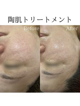 ビューティービューティー(BEAUTY BEAUTY)/陶肌トリートメメント