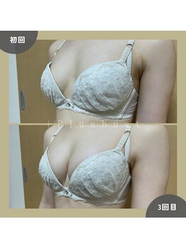 プラス バスト(+Plusバスト)/お客様BeforeAfterお写真