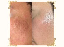 ベルーム(BellRoom)/