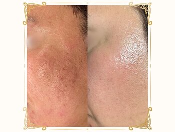 ベルーム(BellRoom)/