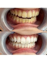 ライトビューティー 池袋店(LightBeauty)/症例写真