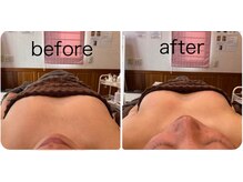 シズク ビューティーサロン(SHIZUKU beauty salon )の雰囲気（1回約30分の施術！NBS Before After AWARD入賞の実力★）
