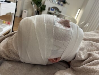 ハニエル(Haniel)の写真/韓国発祥エステでハリツヤのある若々しいお肌へ導きます♪国内最高濃度の炭酸でむくみスッキリ！横顔美人に