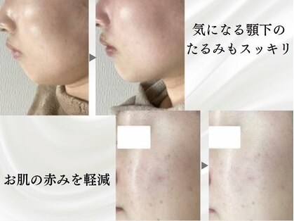 ルピア(L'pur)の写真