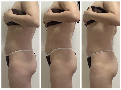 リュクス(LUXE)の写真