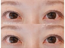 アットイース(at ease)/