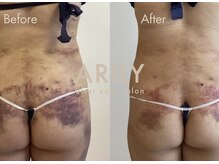 アリリィ(ARILY)/ARILY after care salon