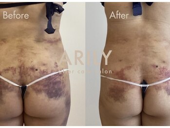 アリリィ(ARILY)/ARILY after care salon