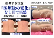 クリニカルエステ イーズ 小倉リバーウォーク北九州デコシティ店