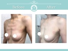 美人バスト 赤羽店/【バストアップ★育乳】症例