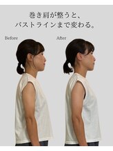 リ バース 立川(RE:birth)/巻き肩改善　BeforeAfter