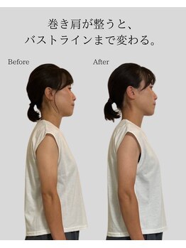 リ バース 立川(RE:birth)/巻き肩改善　BeforeAfter