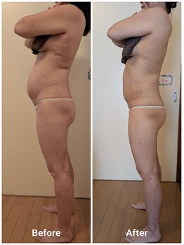 エンダモロジーサロン ココロミ(Cocolomi)の写真/下腹・腰まわり集中の見た目サイズダウン痩身◎通常18700円→初回8800円