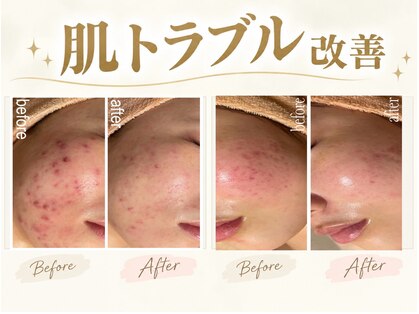 シャルナ(charna)の写真