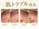 シャルナ(charna)の写真