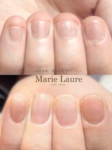 マリーロール 梅田店(Marie Laure)/深爪矯正/自爪育成/自爪風
