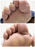【ひび割れ・頑固な角質・魚の目・タコ】足裏角質つるつるケア50分