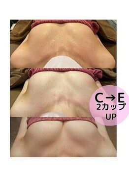 ロココ 国立店(Rococo)/☆C→Eカップへ育乳成功