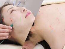 アキュモンド 渋谷院(acumond)の雰囲気（顔～背中までacumond式+微弱電流で内側の不調を徹底的に施術）
