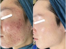 ソリッジ肌管理室