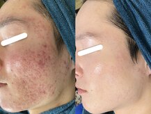 ソリッジ肌管理室