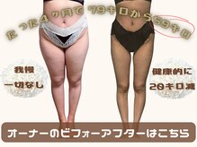 ベベティー(BEBETIE)